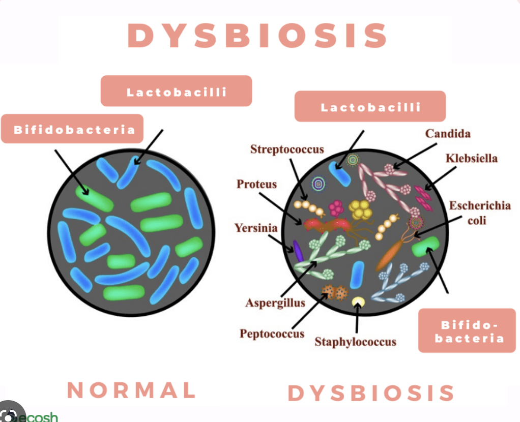 Illustration of gut dysbiosis